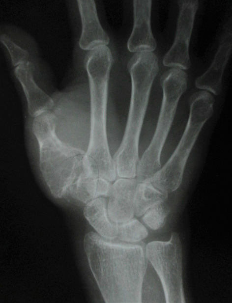 Click here to view Large Image