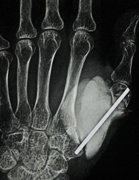 Click here to view Large Image