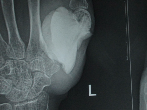 Click here to view Large Image