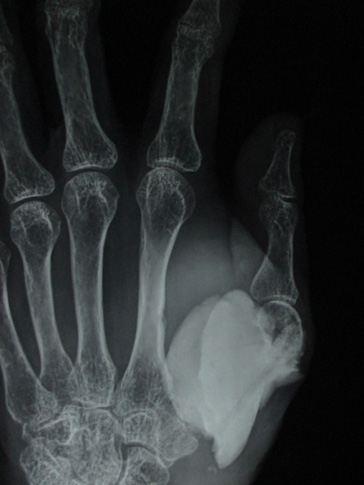 Click here to view Large Image